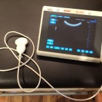 portable_ultrasound_unit2